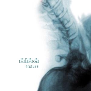 Ulna - Frcture