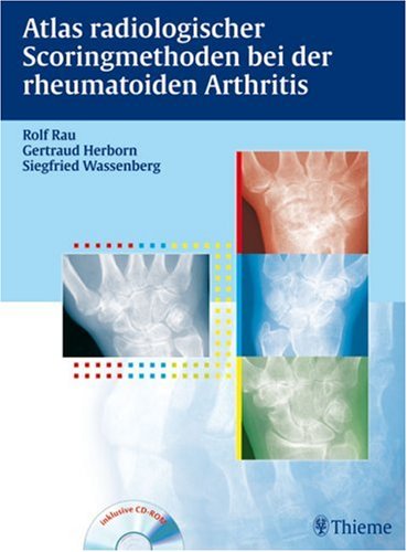 Rau, Rolf / Herborn, Gertraud / Wassenberg, Siegfried - Atlas der Scoringmethoden bei der rheumatoiden Arthritis: Inkl. CD-ROM mit Buch als pdf