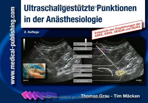  - Ultraschallgestützte Punktionen in der Anästhesiologie